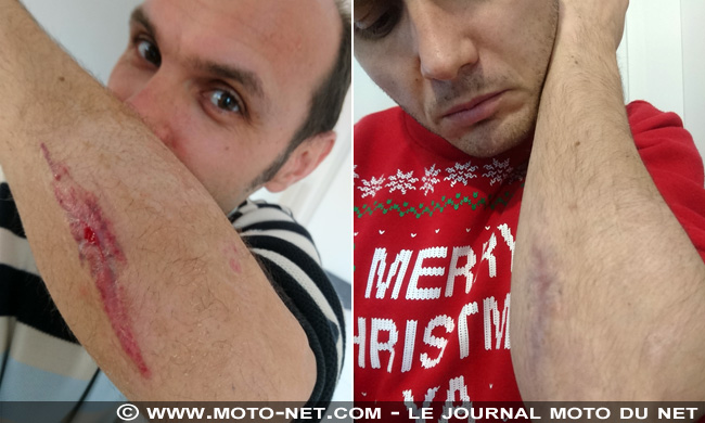 Chute à moto : quand Moto-Net.Com s'offrait une bûche pour Noël